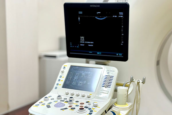 超音波診断装置